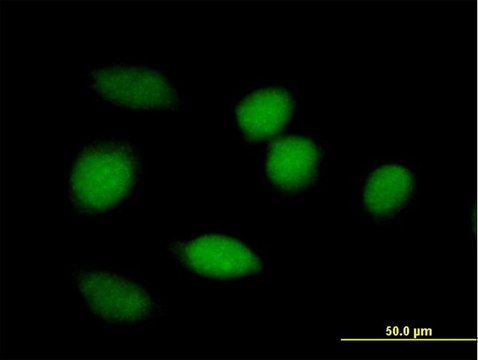 Anti-BLVRA antibody produced in mouse purified immunoglobulin, buffered aqueous solution