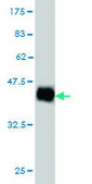 Monoclonal Anti-NDUFS4 antibody produced in mouse clone 1A1, purified immunoglobulin, buffered aqueous solution