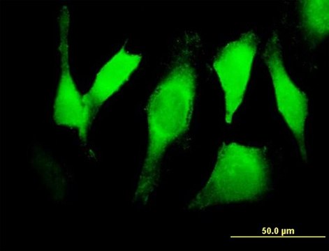 Anti-EGFR antibody produced in mouse purified immunoglobulin, buffered aqueous solution