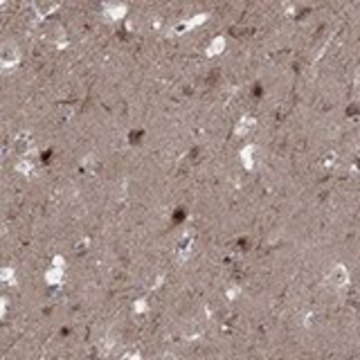 Anti-PLCL2 antibody produced in rabbit Prestige Antibodies&#174; Powered by Atlas Antibodies, affinity isolated antibody, buffered aqueous glycerol solution