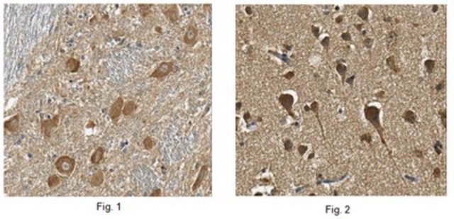 Anti-Neuroglobin Antibody, clone 6G1.1 clone 6G1.1, from mouse