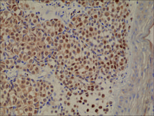Anti-MUM1/IRF4 antibody, Rabbit monoclonal recombinant, expressed in HEK 293 cells, clone RM352, purified immunoglobulin