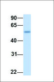 Anti-HNF1B antibody produced in rabbit affinity isolated antibody