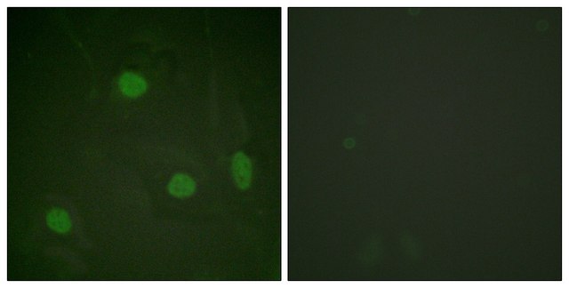 Anti-Histone H3 (Acetyl-Lys23) antibody produced in rabbit affinity isolated antibody