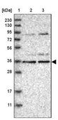 Anti-KLHDC3 antibody produced in rabbit Prestige Antibodies® Powered by Atlas Antibodies, affinity isolated antibody, buffered aqueous glycerol solution, ab1