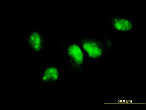 ANTI-PIM1 antibody produced in mouse clone 3D12, purified immunoglobulin, buffered aqueous solution