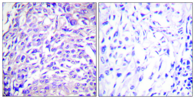 Anti-FOXO1A antibody produced in rabbit affinity isolated antibody