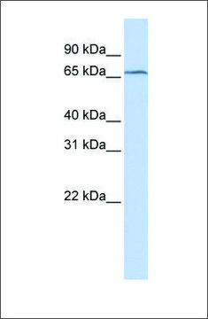 Anti-TRMT5 antibody produced in rabbit affinity isolated antibody