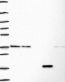 Anti-FBL antibody produced in rabbit Prestige Antibodies® Powered by Atlas Antibodies, affinity isolated antibody, buffered aqueous glycerol solution