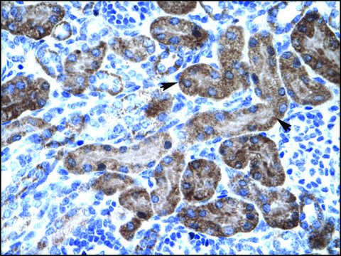 抗TRIM31 兔抗 affinity isolated antibody