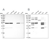 Anti-IKBIP antibody produced in rabbit affinity isolated antibody
