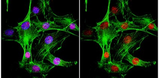 Anti-MDC1 Antibody, clone P2B11 clone P2B11, from mouse