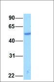Anti-RARA antibody produced in rabbit affinity isolated antibody