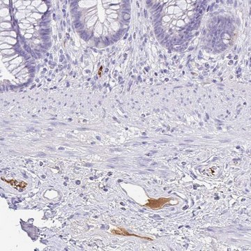 Anti-CFH antibody produced in rabbit Prestige Antibodies&#174; Powered by Atlas Antibodies, affinity isolated antibody, buffered aqueous glycerol solution