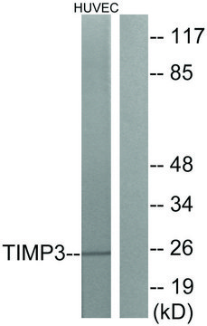 Anti-TIMP3 antibody produced in rabbit affinity isolated antibody