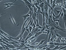 OSUMMER.5 Mouse NRAS-Mutant Melanoma Cell Line