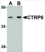Anti-CTRP6 antibody produced in rabbit affinity isolated antibody, buffered aqueous solution