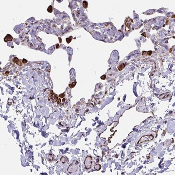 Anti-CACNG3 antibody produced in rabbit Prestige Antibodies&#174; Powered by Atlas Antibodies, affinity isolated antibody, buffered aqueous glycerol solution