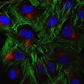 Anti-TAP2 Antibody, clone 429.4 clone 429.4, from mouse