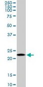 Monoclonal Anti-RPS5, (C-terminal) antibody produced in mouse clone 3G3, purified immunoglobulin, buffered aqueous solution