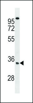 ANTI-SOST(N-TERMINAL) antibody produced in rabbit IgG fraction of antiserum, buffered aqueous solution