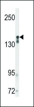 ANTI-VGFR2 antibody produced in rabbit purified immunoglobulin, buffered aqueous solution