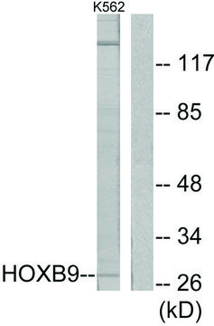 Anti-HOXB9 antibody produced in rabbit affinity isolated antibody