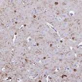 Anti-ERMN antibody produced in rabbit Prestige Antibodies® Powered by Atlas Antibodies, affinity isolated antibody, buffered aqueous glycerol solution