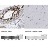 Anti-CREM antibody produced in rabbit Prestige Antibodies® Powered by Atlas Antibodies, affinity isolated antibody, buffered aqueous glycerol solution