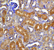 Anti-CAD antibody produced in rabbit affinity isolated antibody