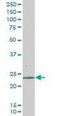 Monoclonal Anti-RAB43 antibody produced in mouse clone 5G4, purified immunoglobulin, buffered aqueous solution