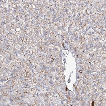 Anti-FAM208B antibody produced in rabbit Prestige Antibodies&#174; Powered by Atlas Antibodies, affinity isolated antibody, buffered aqueous glycerol solution