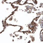 Anti-PIEZO1 antibody produced in rabbit Prestige Antibodies® Powered by Atlas Antibodies, affinity isolated antibody, buffered aqueous glycerol solution