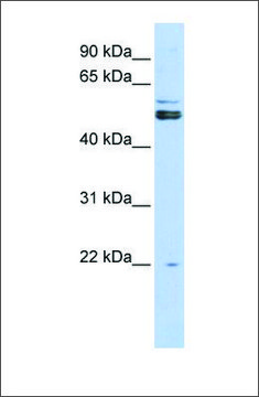 Anti-PRMT2 antibody produced in rabbit affinity isolated antibody