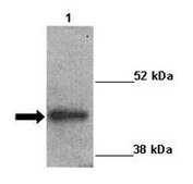 Anti-ARRB2 antibody produced in rabbit affinity isolated antibody