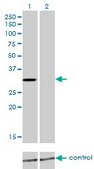 Monoclonal Anti-KCNIP2 antibody produced in mouse clone 3E7, purified immunoglobulin, buffered aqueous solution