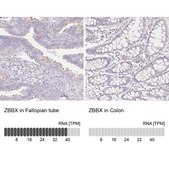 Anti-ZBBX antibody produced in rabbit Prestige Antibodies® Powered by Atlas Antibodies, affinity isolated antibody, buffered aqueous glycerol solution