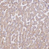 Anti-WDR62 antibody produced in rabbit Prestige Antibodies® Powered by Atlas Antibodies, affinity isolated antibody, buffered aqueous glycerol solution