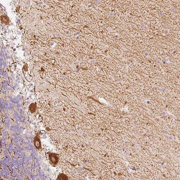 Anti-SLC20A1 antibody produced in rabbit Prestige Antibodies&#174; Powered by Atlas Antibodies, affinity isolated antibody, buffered aqueous glycerol solution