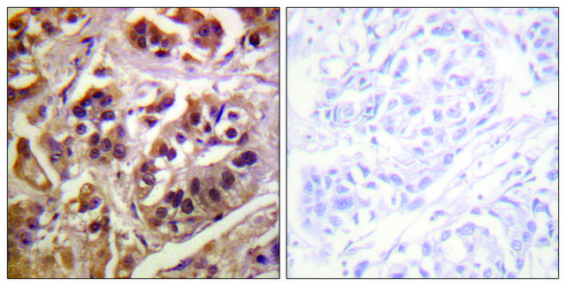 Anti-IKK-&#947; antibody produced in rabbit affinity isolated antibody