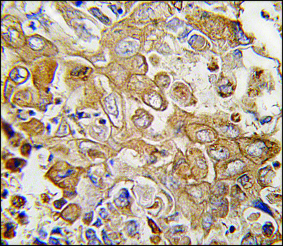 Anti-LECT1 (N-term) antibody produced in rabbit saturated ammonium sulfate (SAS) precipitated, buffered aqueous solution