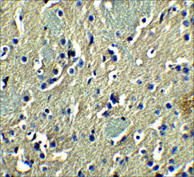 Anti-PION antibody produced in rabbit affinity isolated antibody, buffered aqueous solution