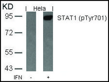 Anti-phospho-STAT1 (pTyr701) antibody produced in rabbit affinity isolated antibody