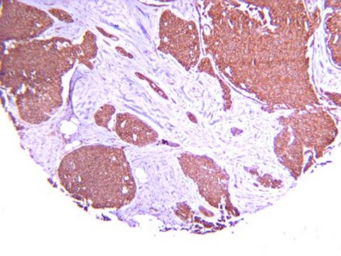 Anti-Hypoxia Inducible Factor 1 &#945; Antibody, clone H1&#945;67 clone H1alpha67, Chemicon&#174;, from mouse