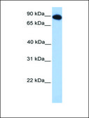 Anti-FOXO3 antibody produced in rabbit affinity isolated antibody