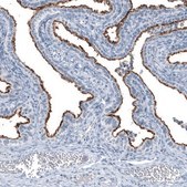 Monoclonal Anti-MUC1 antibody produced in mouse Prestige Antibodies® Powered by Atlas Antibodies, clone CL8733, purified immunoglobulin, buffered aqueous glycerol solution