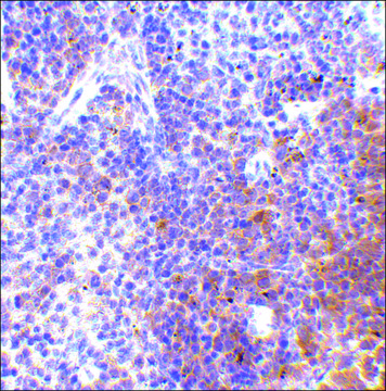 Anti-IRF7 (ab1) antibody produced in rabbit affinity isolated antibody, buffered aqueous solution