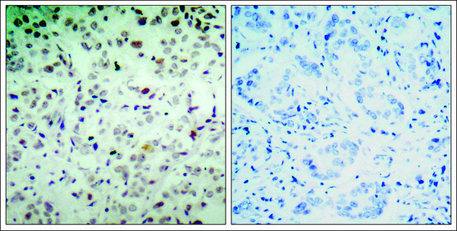 Anti-phospho-RB1 (pSer780) antibody produced in rabbit affinity isolated antibody