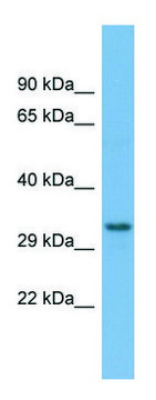 Anti-TAMM41 (C-terminal) antibody produced in rabbit affinity isolated antibody