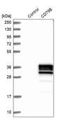 Anti-CD79B antibody produced in rabbit Prestige Antibodies® Powered by Atlas Antibodies, affinity isolated antibody, buffered aqueous glycerol solution